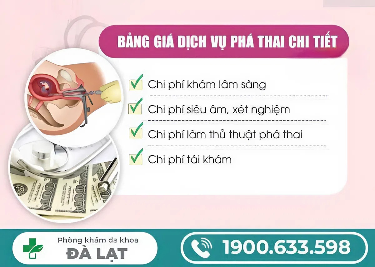 Hình ảnh minh họa